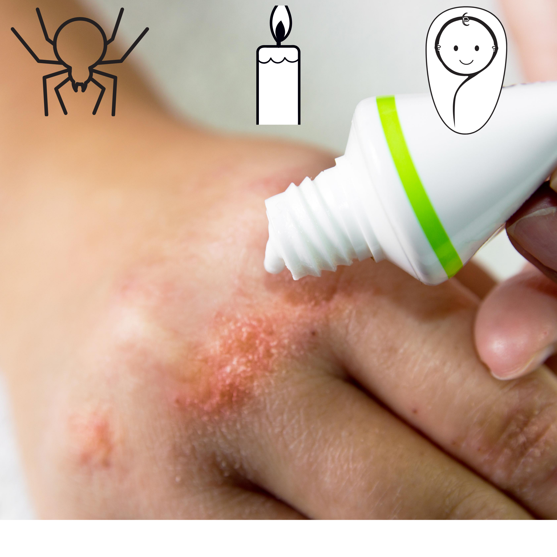 Pasta de Lassar en San Luis Potosí